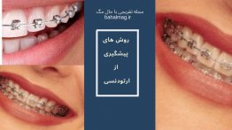 ۷ روش برای پیشگیری از ارتودنسی
