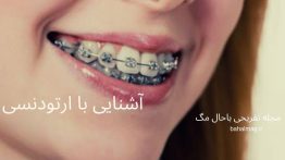آشنایی با ارتودنسی
