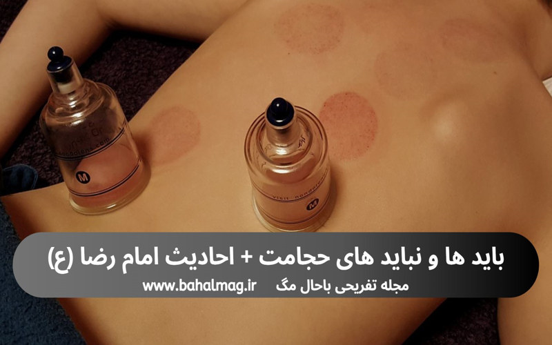 باید-ها-و-نباید-های-حجامت-احادیث
