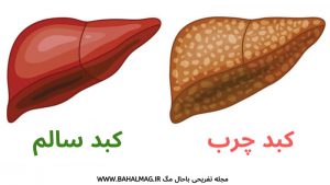 توصیه هایی برای کبد چرب طب اسلامی