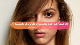 آیا شما هم جزء پوست پرتقالی ها هستید ؟