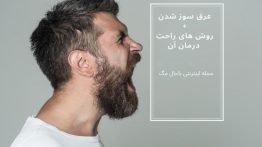 عرق سوز شدن + روش های راحت درمان آن