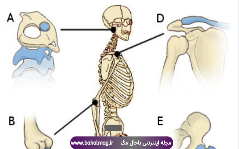 چرا مفاصل در هنگام تمرین صدا میدهند