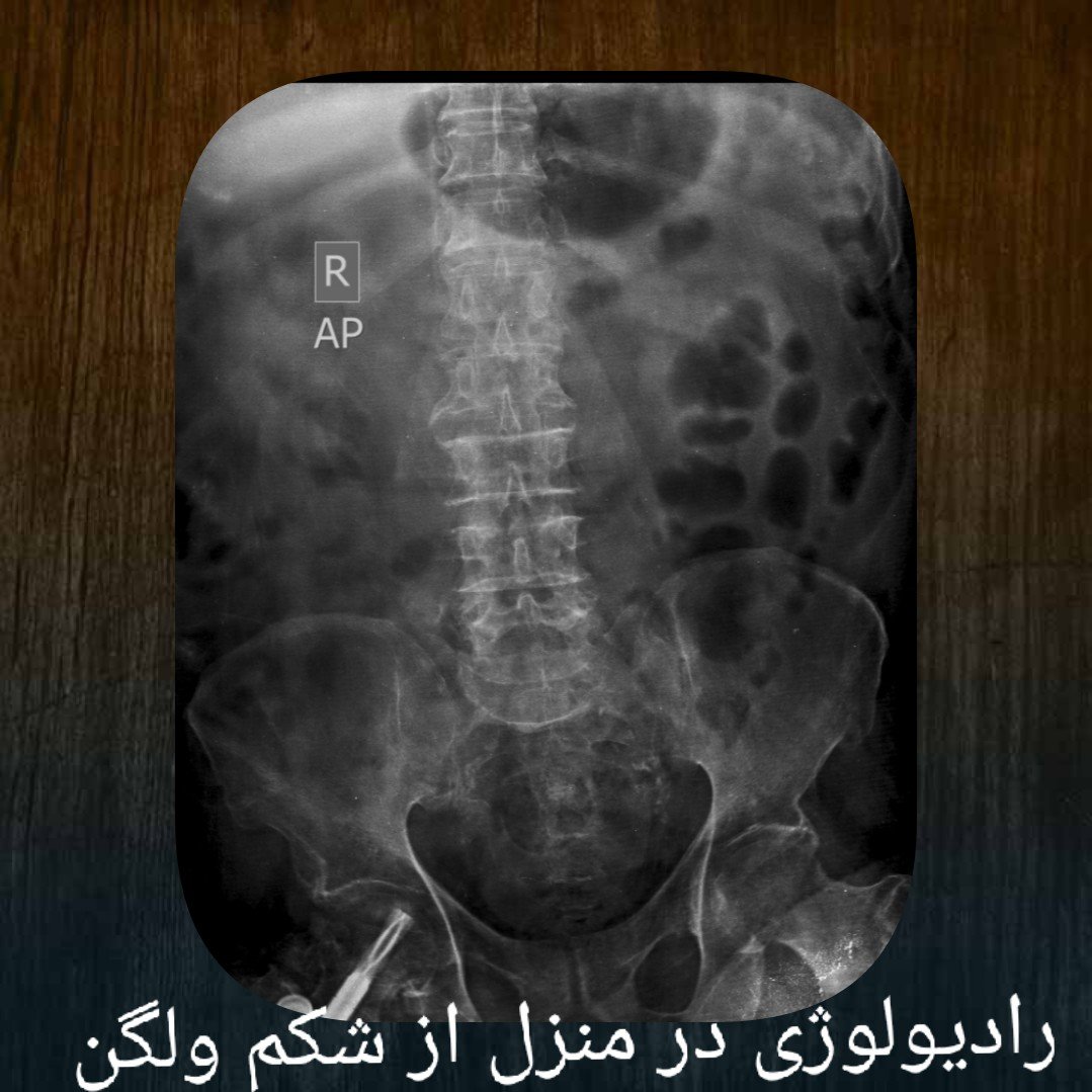 رادیولوژی در منزل تهران کرج اصفهان مشهد قم و شیراز