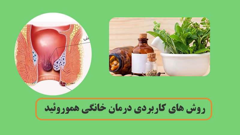 درمان خانگی هموروئید