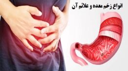 علت زخم معده و پیشگیری از آن