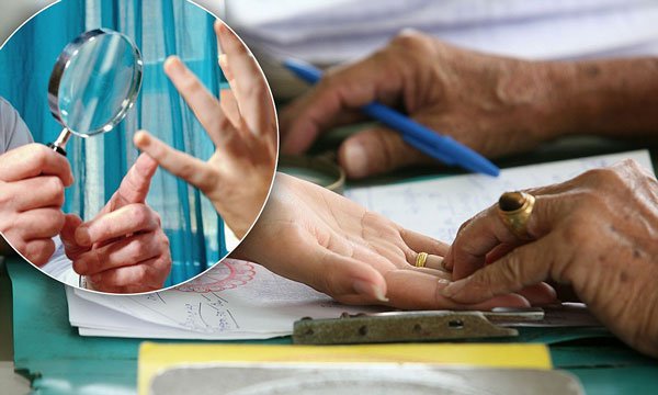 جراحی کف دست