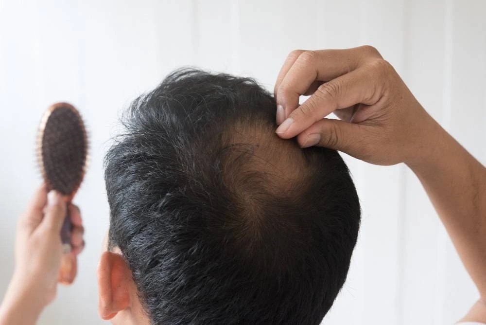 تاثیرات منفی دیابت بر مو