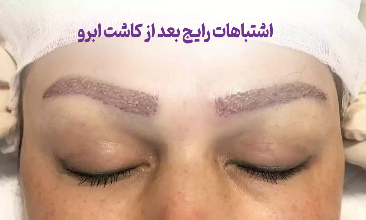 اشتباهات رایج بعد از کاشت ابرو