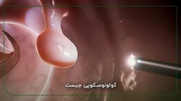 هر بار کولونوسکوپی چقدر است