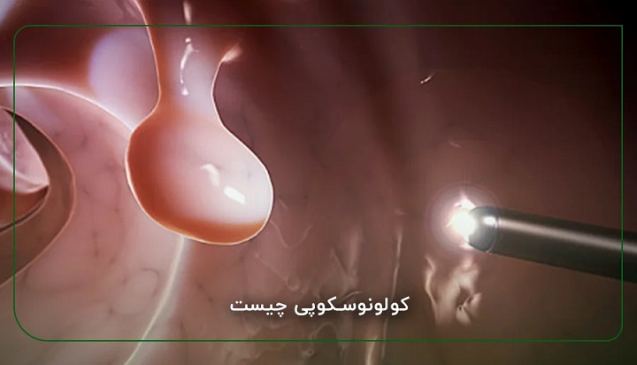 کولونوسکوپی چیست