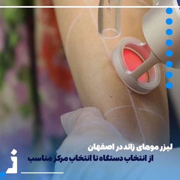 لیزر موهای زائد در اصفهان