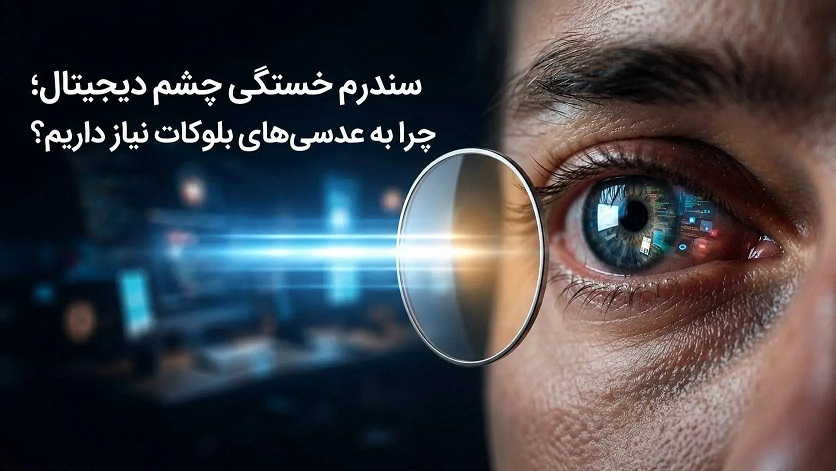 چرا به عدسی های بلوکات نیاز داریم؟